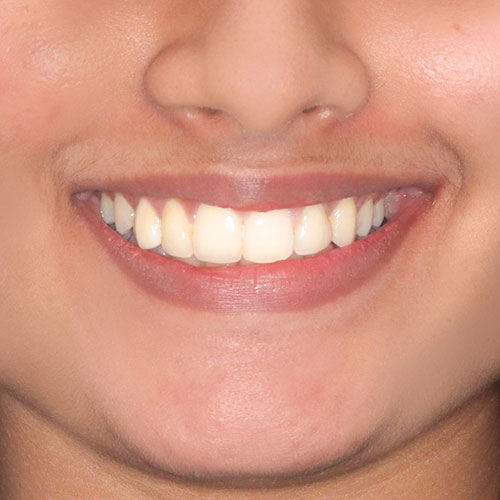 After - Ortho