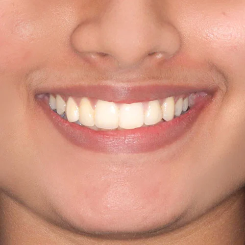 After - Ortho