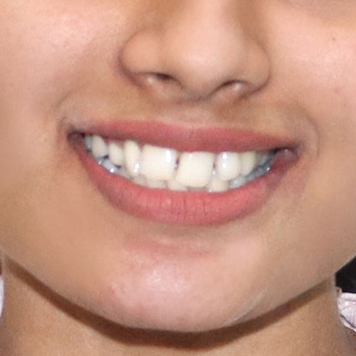 Before - Ortho